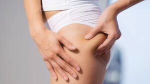 My Secrets Of How To Prevent Cellulite Revealed
